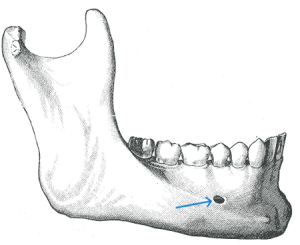 mental_foramen_3_1